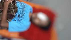 Senjata Mainan Memakan Korban, Remaja di Gowa Tertembak Matanya dan Dilarikan ke RS